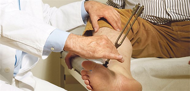 Neuropathie bei schneller HbA1c-Senkung Diagnostik bei Neuropathie: Das Vibrationsempfinden wird mit dem Stimmgabeltest untersucht.