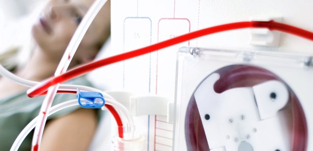 Dialysat mehrfach benutzen? Dialyse: Schöner wäre es sicherlich zu Hause.