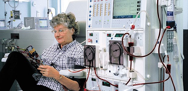 Nierenärzte sind alarmiert Dialyse in Deutschland - die Zahl der Patienten steigt: Von 41.455 im Jahr 1995 bis 63.427 im Jahr 2005.