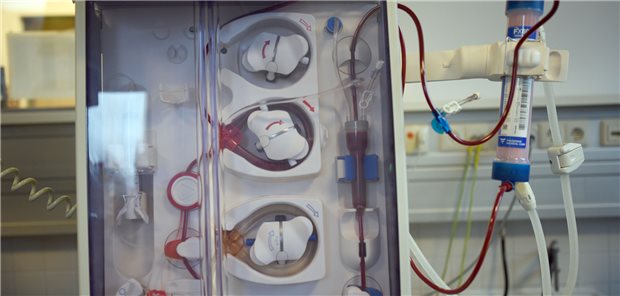 Stiftung Kindergesundheit fürchtet Versorgungsengpässe bei Medizinprodukten Dialysegeräte für Kinder könnten bald Mangelware sein. Viele Kliniken setzen inzwischen ihre Restbestände ein.