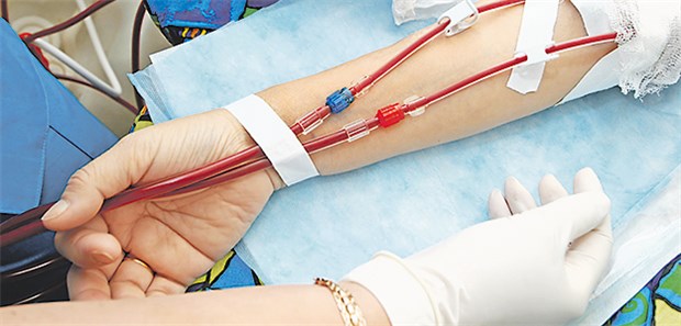 Besseres Outcome mit neuen Kathetern und Shunts Dialyseshunt: Günstig ist die Anastomosierung der A. radialis oder ulnaris.