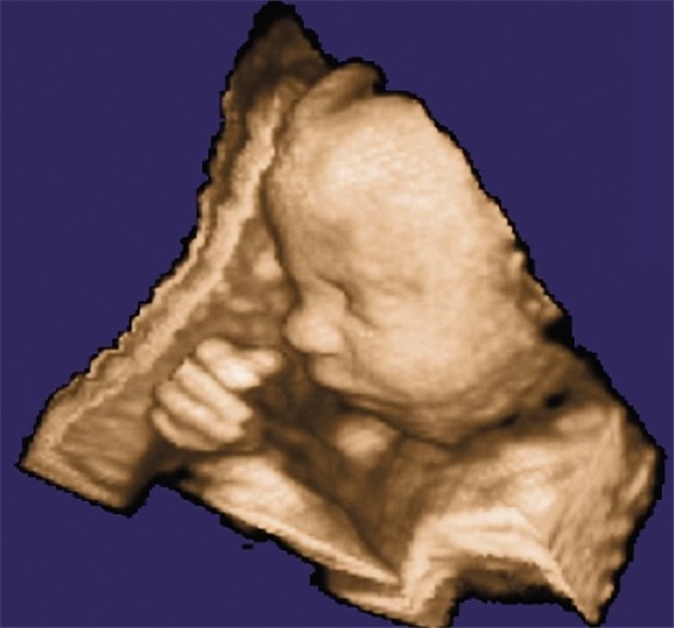 Fehlbildungen immer besser und früher erkennbar Die 3D-Sonografie zeigt detaillierte Aufnahmen eines Ungeborenen.