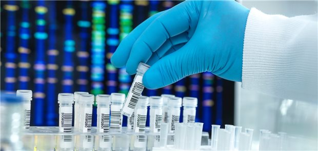 Die ATTRv-Amyloidose kann aufgrund der relativ unspezifischen Symptome nur durch einen Gentest sicher diagnostiziert werden.