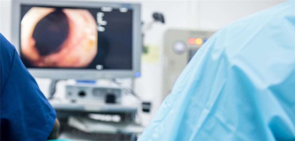 KI bei Koloskopie: Verlern-Risiko