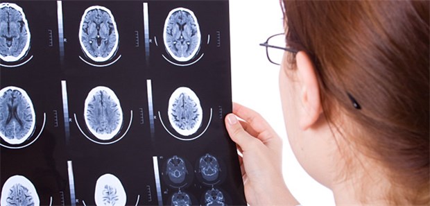 Schadet Strahlenangst mehr als Strahlung? Die Angst vor Strahlung hält so manchen Arzt und Patienten davon ab, möglicherweise lebenswichtige Untersuchungen durchführen zu lassen.