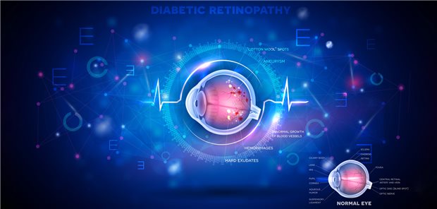 Die Augen sind ein Spiegel für den allgemeinen Gefäßzustand.
