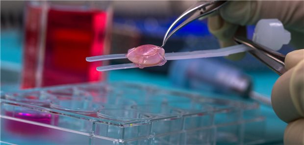 Gewebebank Stuttgart: Über 400 Hornhauttransplantationen im ersten Jahr Die Augenhornhauttransplantation ist weltweit die am häufigsten durchgeführte Transplantation. Allein in Deutschland erhalten jährlich über 9.000 Menschen ein entsprechendes Transplantat.