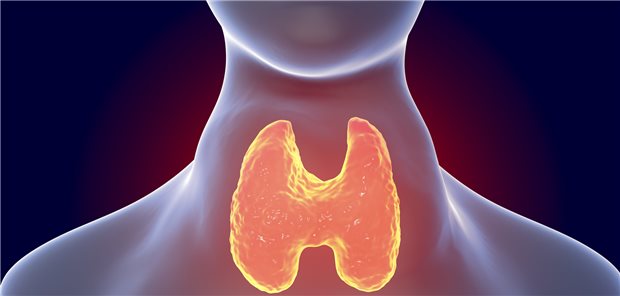 Die Autoimmunerkrankung Morbus Basedow gehört zu den häufigsten Ursachen der Hyperthyreose.
