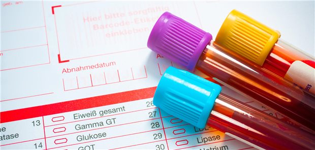 Die Autoren und Autorinnen um Tatjana Rudi resümieren, dass hohe systemische Entzündungsaktivität ein Grund ist, Patienten und Patientinnen mit Rheumatoider Arthritis (RA) und Interstitielle Lungenerkrankung (ILD) zu behandeln – auch wenn es um die Gelenke eigentlich ganz gut bestellt ist.
