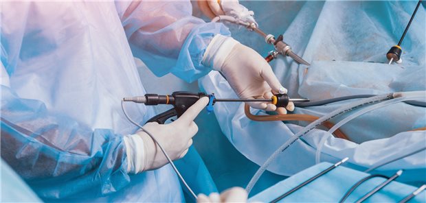 Eine Gruppe von Chirurgen im Operationssaal mit laparoskopischer Ausrüstung die bei einem Patienten eine Kolektomie durchführen.