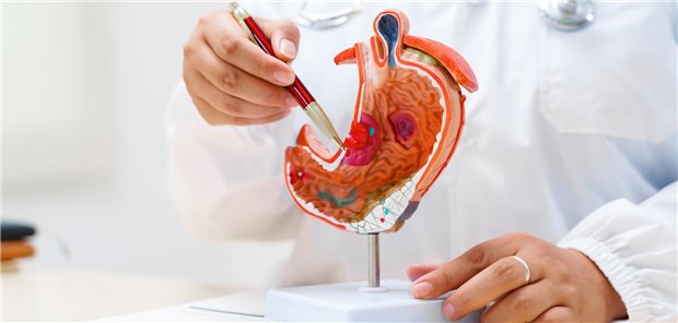 Ein Gastroenterologe verwendet ein anatomisches Modell des menschlichen Magen, um einem Patienten während einer Konsultation in der Klinik die Diagnose und die Behandlungsmöglichkeiten zu erklären.