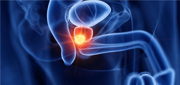 Modell einer Prostata