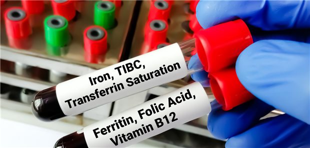 Laborant hält Blutproben für Eisen-, TIBC-, Ferritin- und Folsäure- sowie Vitamin B12-Tests zur Diagnose von Eisenmangel in seiner Hand.