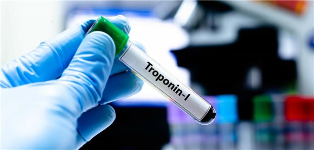 Blutprobe in Probenröhrchen für die Troponin-I-Analyse.