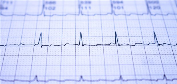 Beispielhafter EKG-Ausschnitt