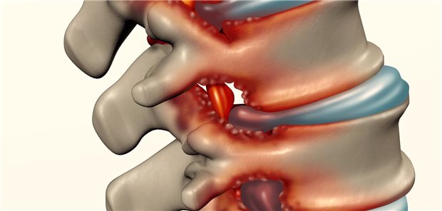 Symbolbild der Wirbelsäule