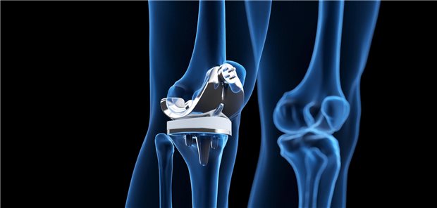 Die Autorinnen und Autoren resümieren, dass sich die Studiendaten für die prä- und postoperative Patientenberatung nutzen lassen.