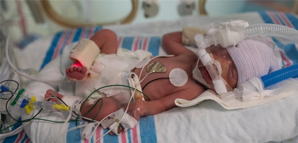 Premature Babies: Probiotics’ Impact