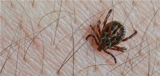 Gefahr von Zeckenbissen auch im Winter Die Auwaldzecke auf der Haut. Sie breitet sich in Deutschland stark aus.