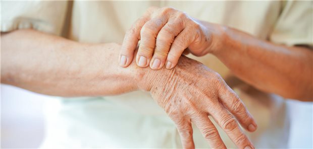 Schmerzen im Handgelenk bei älterer Frau mit rheumatoider Arthritis.