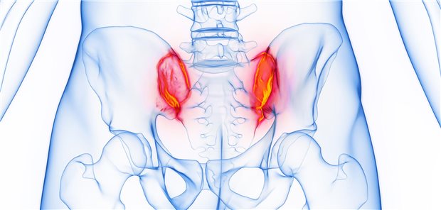 Medizinische Darstellung von Knochmarködemen im Beckenknochen