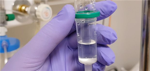 Ein Medikament wird im Krankenhaus per Infusion gegeben