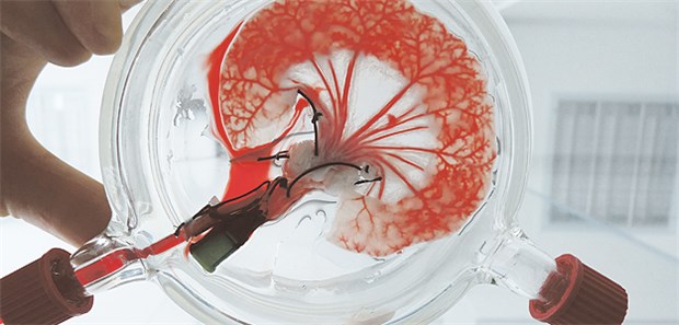 Neues Translationszentrum soll Krebsforschung forantreiben Die BioVaSc-TERM ist eine Trägerstruktur für das Tissue Engineering. Über die intakte Blutgefäßstruktur wird das Gewebe mit Nährstoffen versorgt.