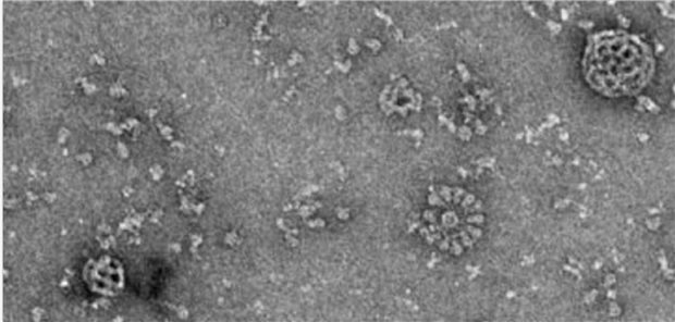 Die COVID-Vakzine unter dem Elektronenmikroskop mit Matrix-M Adjuvans-Partikel und Antigen-Partikel mit SARS-CoV-2-Spikeproteinen.