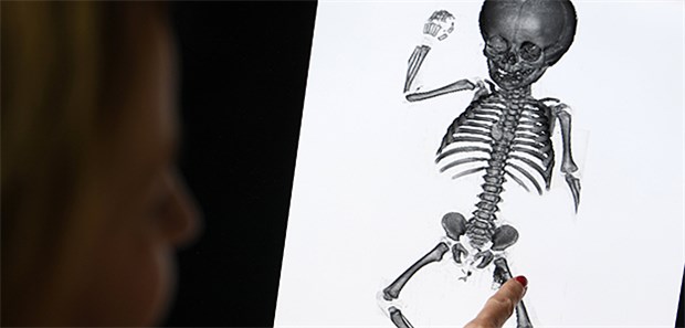 Letzte Ruhe für Kinder aus der Anatomie Die CT-Aufnahme des Leichnams eines acht Monate alten Säuglings. Vom Fötus bis zu einem 14-jährigen Jungen, lagerten seit Jahrzehnten konservierte Leichen in einem Keller des Instituts für Anatomie und Zellbiologie an der Universität in Halle/Saale. Die Kinder kamen von 1920 bis 1940 ganz offiziell in die Anatomie.