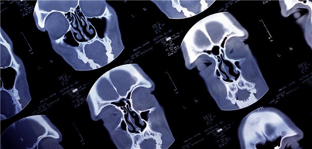 Aufnahmen eines CT des Schädels eines Patienten.