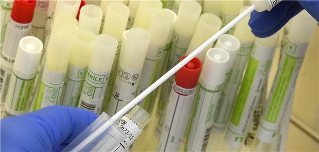 Diagnostica-Branche mit deutlichem Umsatzrückgang Die Coronadiagnostik machte im Jahr 2022 noch 37 Prozent des Gesamtmarkts aus, im Vergleich zu 65 Prozent im Vorjahr.