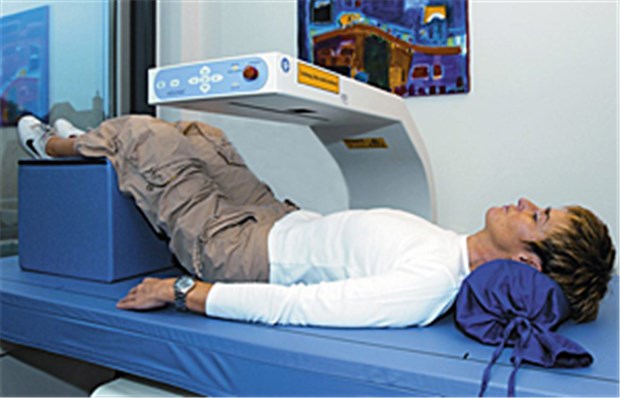 CT zeigt die Knochenfestigkeit besser als DXA Die DXA-Messung ist stark bei der Diagnostik vor der Therapie, aber schwach bei der Therapie-Überwachung.