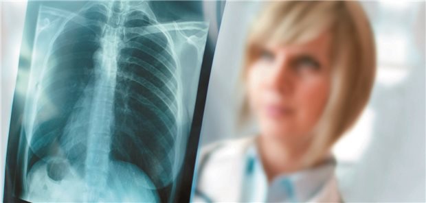 Die Daten der Krebsregister sollen über eine Plattform besser in die onkologische Versorgung und Forschung gebracht werden.
