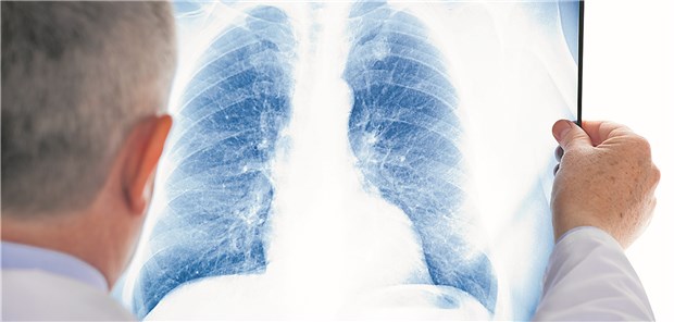 AOK hinterfragt Radiologen-Vereinbarungen Die Debatte um die Abrechnungspraxis der Radiologen geht weiter. Die Kassen wollen neu verhandeln. Die KV Niedersachsen verteidigt die bisherige Praxis.