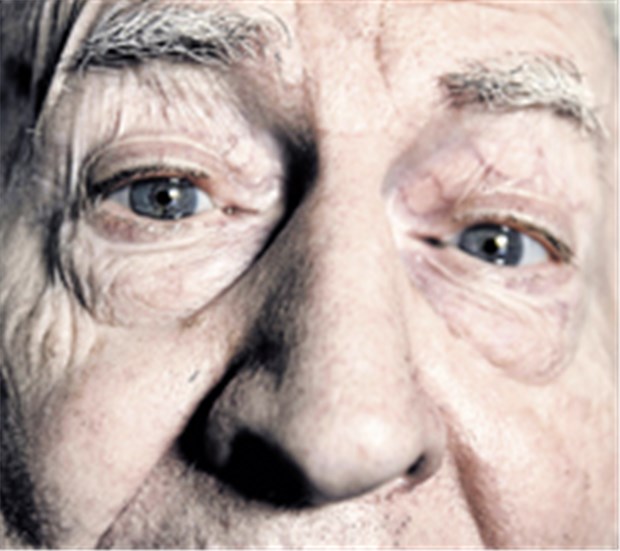 Neues in Sachen Diagnostik und Therapie bei Alzheimer Die Demenz vom Alzheimer-Typ ist in Deutschland die häufigste psychiatrische Erkrankung im Alter. Über eine Million Menschen sind davon betroffen.