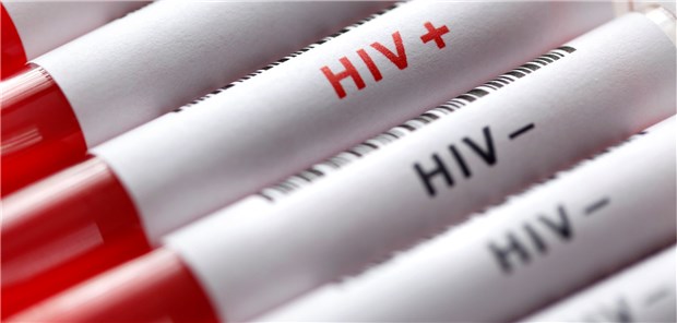 Die Deutsche AIDS-Hilfe nennt sie einen Meilenstein für die HIV-Prävention: die PrEP.