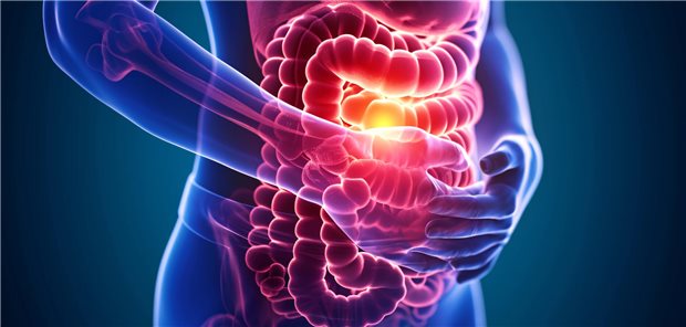Die Diagnose Reizdarm-Syndrom (RDS) bekamen in der Zöliakiegruppe 2,7 Prozent, in der Kontrollgruppe waren es nur 0,9 Prozent. Damit entfiel auf 60 Zöliakiepatienten im Lauf von zehn Jahren eine zusätzliche RDS-Diagnose. Unter Berücksichtigung weiterer Einflussfaktoren entsprach dies einer Risikosteigerung auf das 3,1-Fache, mit ähnlichen Werten für RDS vom Diarrhö- und vom Nicht-Diarrhö-Typ. 