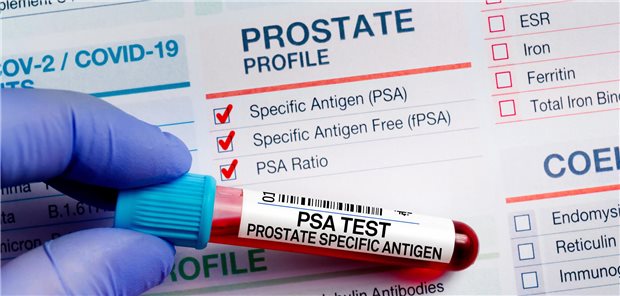 Ein Labortechniker hält ein Blutröhrchen in seinen Händen. Im Hintergrund ist das Anforderungsformular für den mit der Blutprobe durchzuführenden PSA-Test zu sehen.