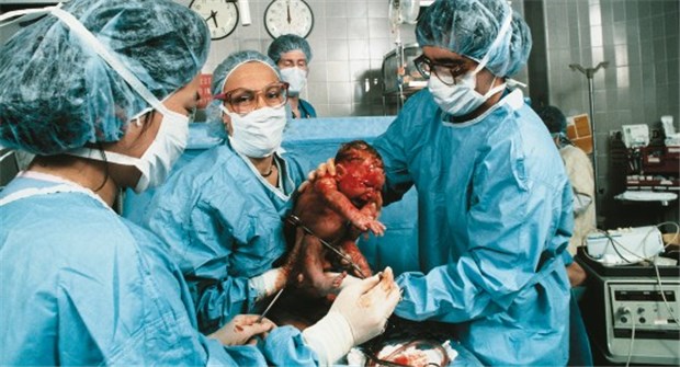 Prüfungen durch externe Experten verbessern die Behandlungsqualität in den Kliniken Die Einhaltung der 20-Minuten-Grenze bis zur Geburt wird bei Notfallkaiserschnitten noch zu häufig verfehlt, meinen die BQS-Experten.
