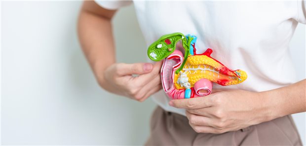 Die Empfehlungen zur Erstlinientherapie eines Pankreaskarzinoms wurden um den Wirkstoff NALIRIFOX erweitert.