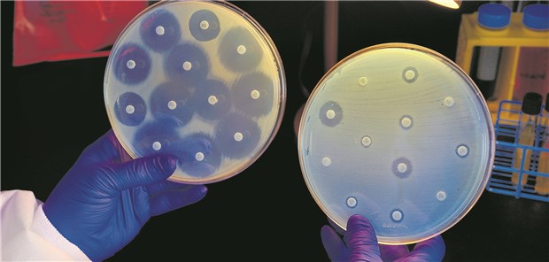 Abgewandelte Nutzenbewertung angedacht Die Entwicklung neuer Antibiotika ist von Besonderheiten gepräg, betont ein Hersteller.t