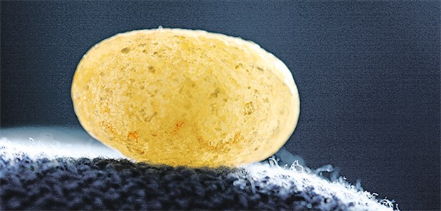 Die Erfolgsquote für einen Steinabgang war unter Alphablockertherapie um 46 Prozent höher als unter Placebo.