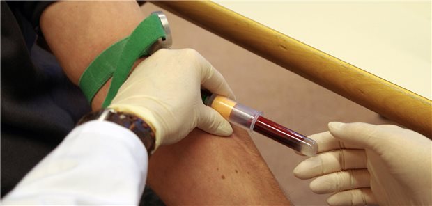 Die FDA betont, dass der Bluttest nicht als Screening- oder eigenständiger diagnostischer Test gedacht ist und, dass andere klinische Bewertungen oder zusätzliche Tests zur Bestimmung der Behandlungsoptionen herangezogen werden sollten.