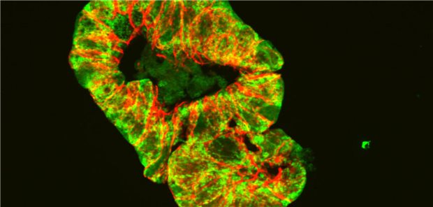 Störung in Mitochondrien als möglicher Auslöser von Morbus Crohn entdeckt Die Forschenden nutzten in ihrer Studie Darm-Organoide, um die Verletzung im Darmepithel aufzuzeigen. In dieser mikroskopischen Aufnahme eines Darm-Organoids sind die Umrisse der Epithelzellen in Rot dargestellt, die Mitochondrien sind Grün eingefärbt.
