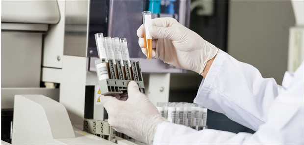 Die Forschenden resümieren, dass es wünschenswert wäre, die Methotrexat-Urin-Dosis (METU) in einer neuen Studie bei Patienten mit Rheumatoider Arthritis (RA) mit unklarem Therapieansprechen zu untersuchen, um es für die Prävention der Eskalation der therapeutischen Strategie in Betracht zu ziehen.