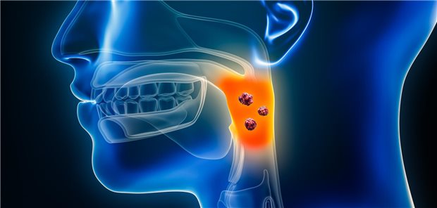 Die Forschenden um Frederick Durrant resümieren, dass die Ergebnisse ihrer Studie darauf hindeuten, dass eine vielversprechende Zielgruppe für ein Screening auf HPV-positive Oropharyngealkarzinome Personen sein könnten, die Oralsex praktizieren, eine hohe Anzahl von Sexualpartnern sowie eine Vorgeschichte mit STI haben und junge, weiße Männer sind.