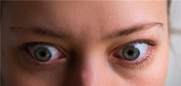 Die Forschungsgruppe um George J. Kahaly resümiert, dass Teprotumumab die erste Pharmakotherapie ist, die in drei sechsmonatigen Studien eine bedeutsame Wirkung auf den Exophthalmus wie auch auf Diplopie bei einer endokrinen Orbitopathie hatte.