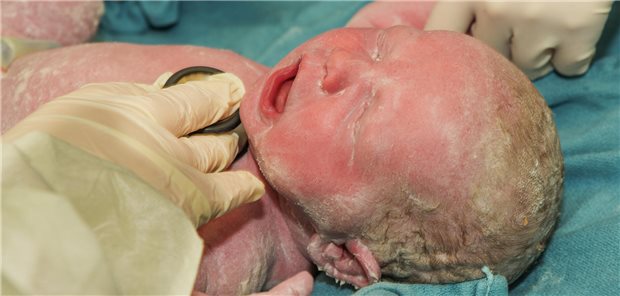 Neugeborenes wird kurz nach der Geburt im Krankenhaus untersucht und behandelt.