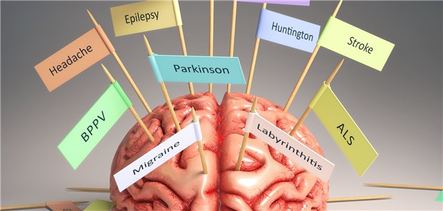 Durcheinander beim Super-Nano-Origami Die Gemeinsamkeit einiger neurodegenerativer Erkrankungen wie die Alzheimer-, Parkinson- und Huntington-Krankheit ist die Verklumpung von Proteinen in Neuronen.