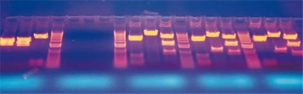 In Großbritannien heiß diskutiert: eine Ausweitung der Präimplantationsdiagnostik Die Genanalyse zeigt: Welche Gene sind vorhanden und welche nicht?